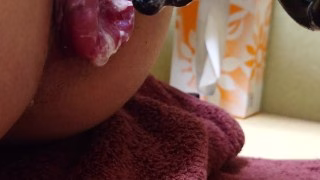 アナル吸引　アナルローズ拡張2